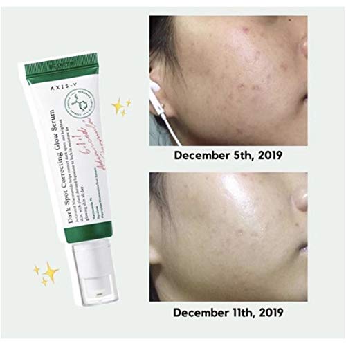 Dark Spot Correcting Glow Serum
