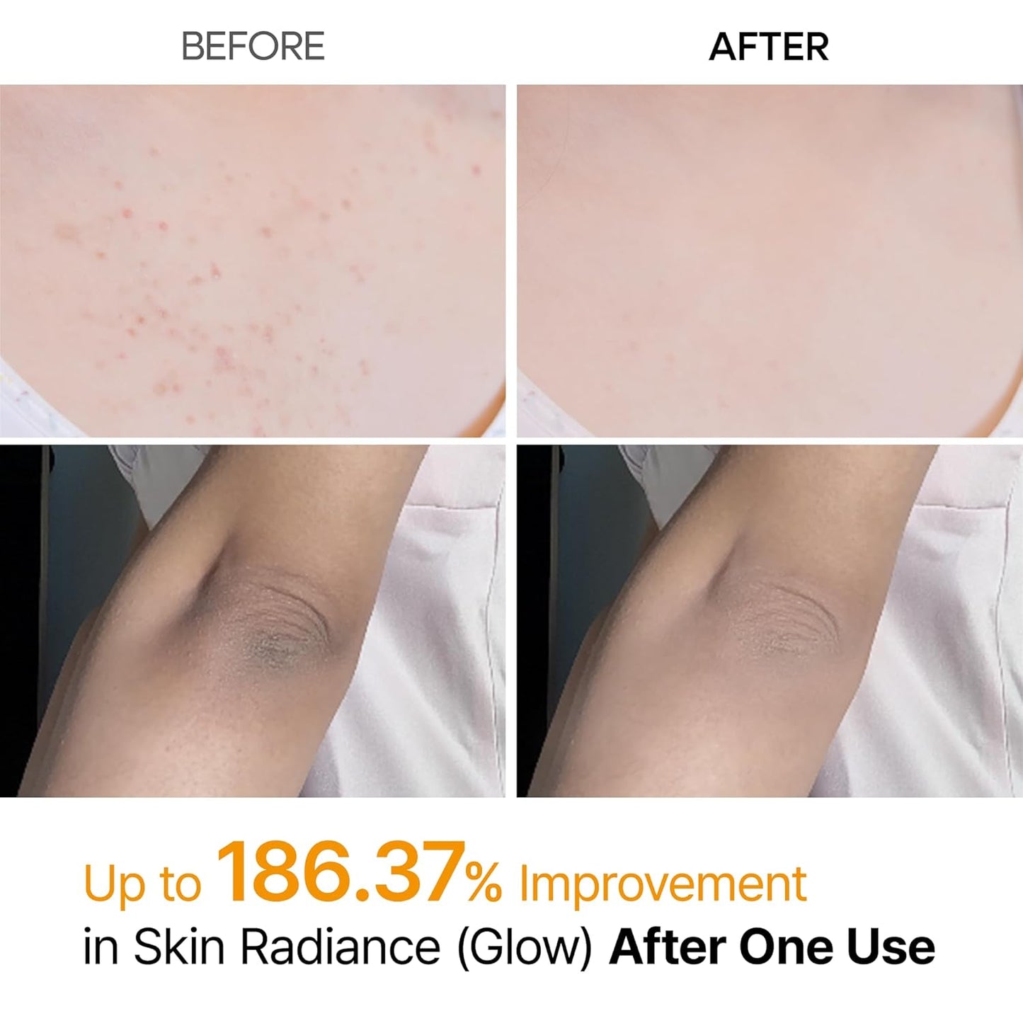 Peel Shot Exfoliating Kojic Acid Turmeric Spray
